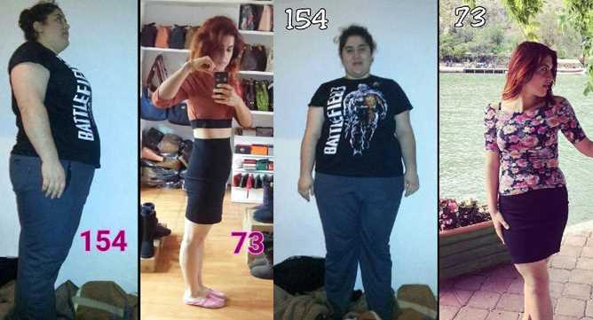 Девушка из Муглы похудела к лету на 81 кг