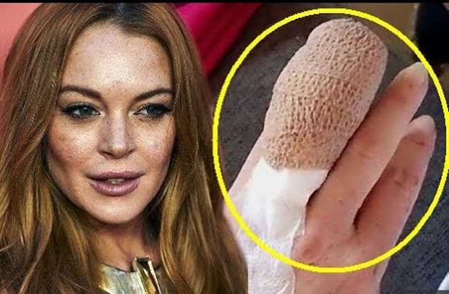 Линдси Лохан лишилась половины пальца в Бодруме