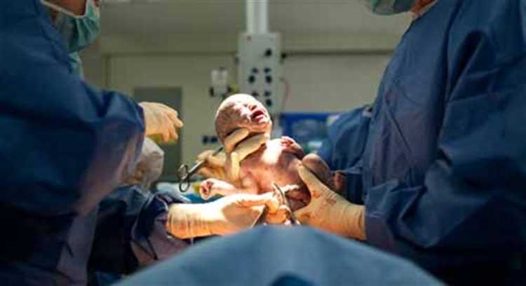 54% родов в Турции проведены через кесарево сечение