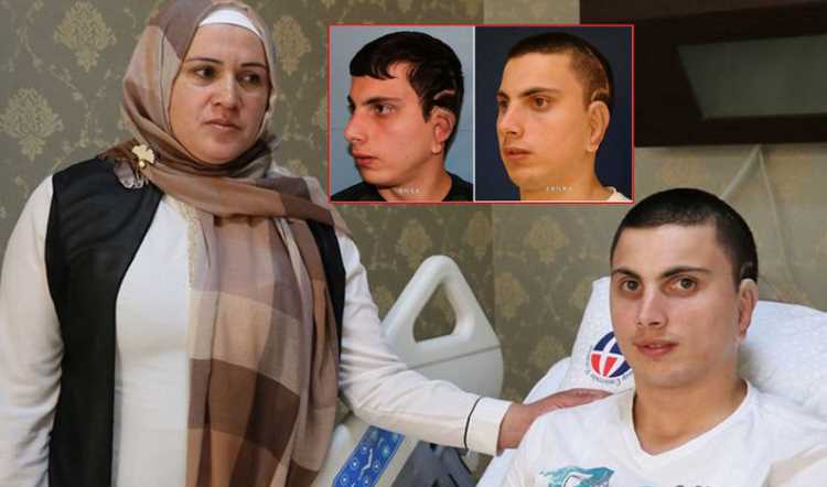 Турецкие врачи сделали парню ухо из ребра матери