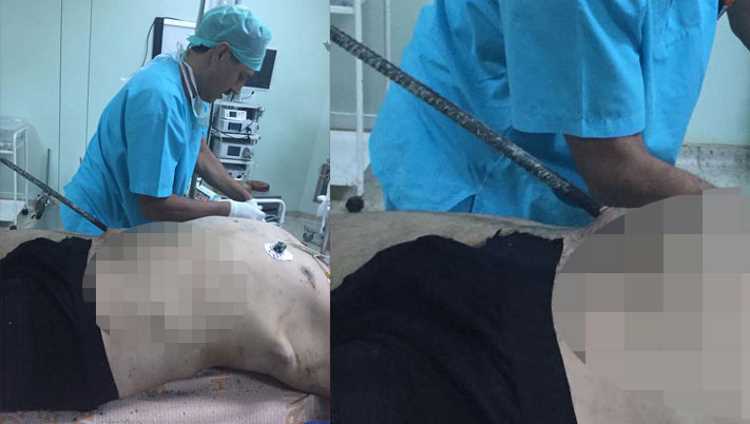 Метровый штырь и чудом выживший строитель