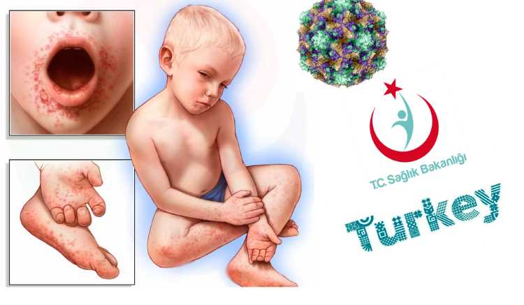 Коксаки: Москва проверит отели и больницы Антальи