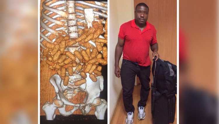 Нигериец провез в себе 2 кг кокаина в Стамбул