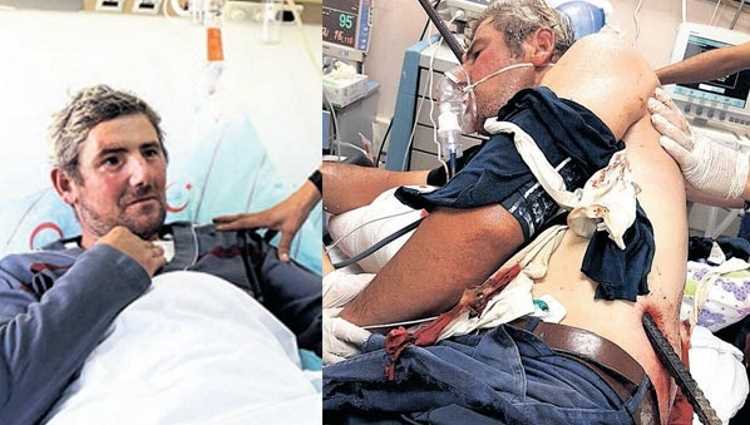 Врачи совершили чудо после несчастного случая на стройке