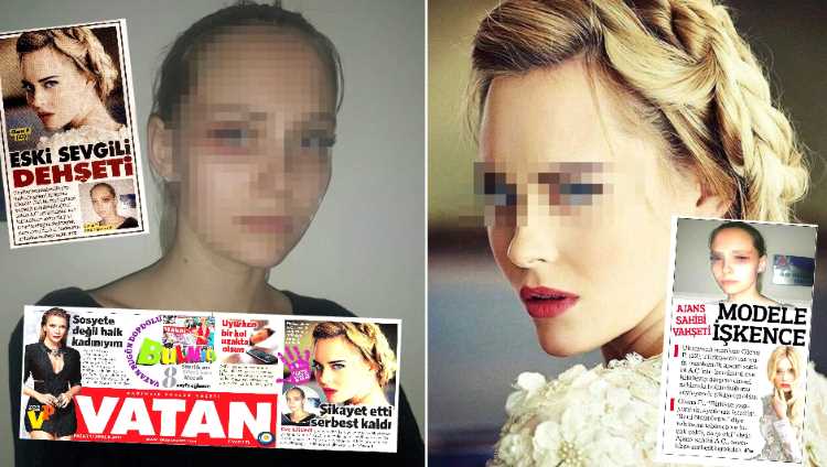 Украинская модель оказалась на первых полосах турецких СМИ