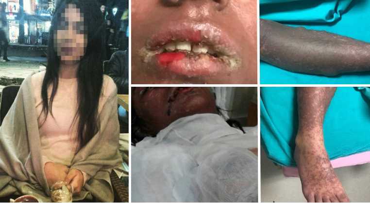 15-летняя школьница умирает от выписанных лекарств