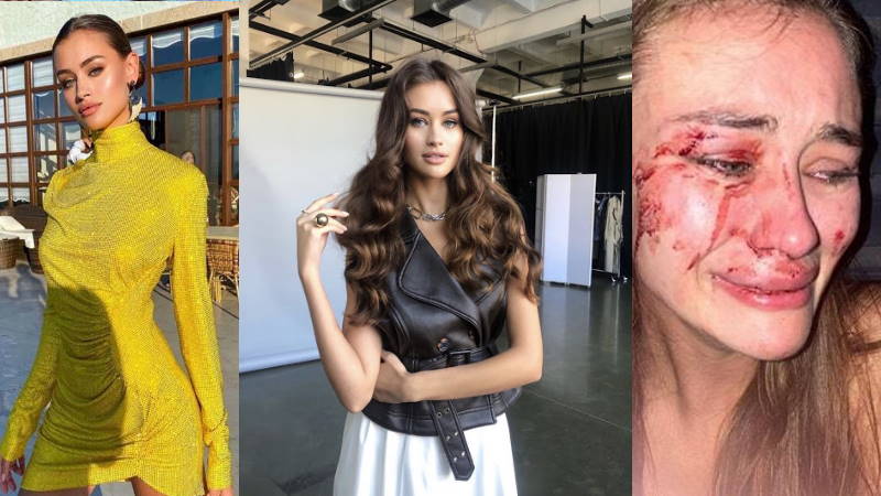 Украинскую топ-модель избили охранники пляжа в Чешме