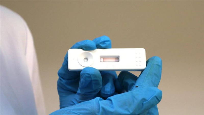 В Турции создали 8-минутный тест на COVID-19