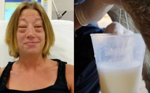 Молоко ослицы чуть не забрало жизнь анталийки