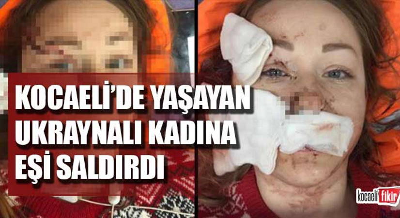 Украинка попала в заголовки турецких газет