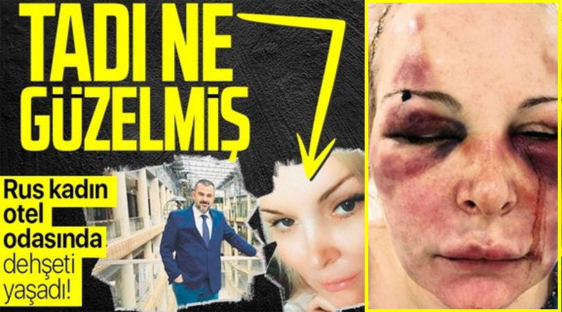 Два дня избивал россиянку в отеле