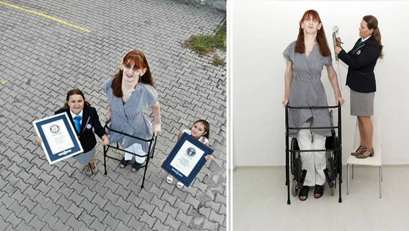 Турчанка признана самой высокой женщиной в мире