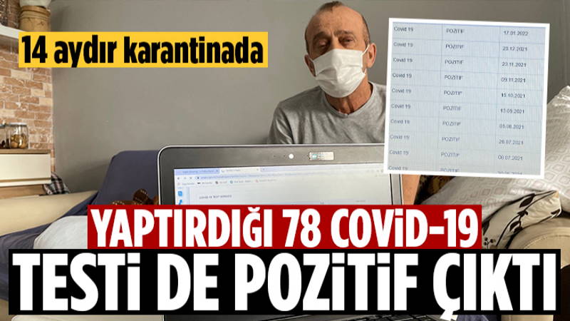 Житель Турции болеет COVID более 14 месяцев